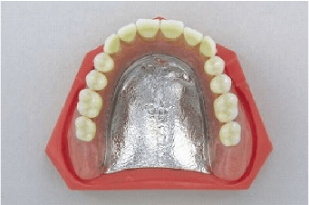 金属床義歯（コバルトクロム合金）イメージ