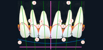 歯の配列・位置