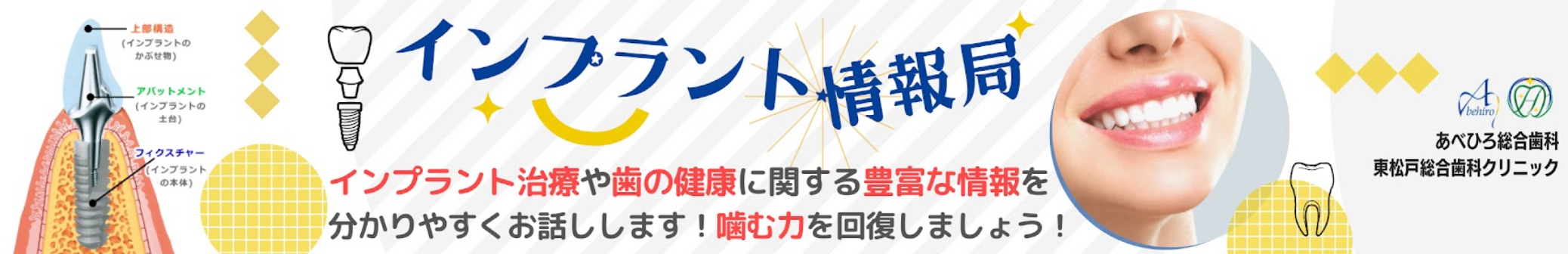 インプラント情報局
