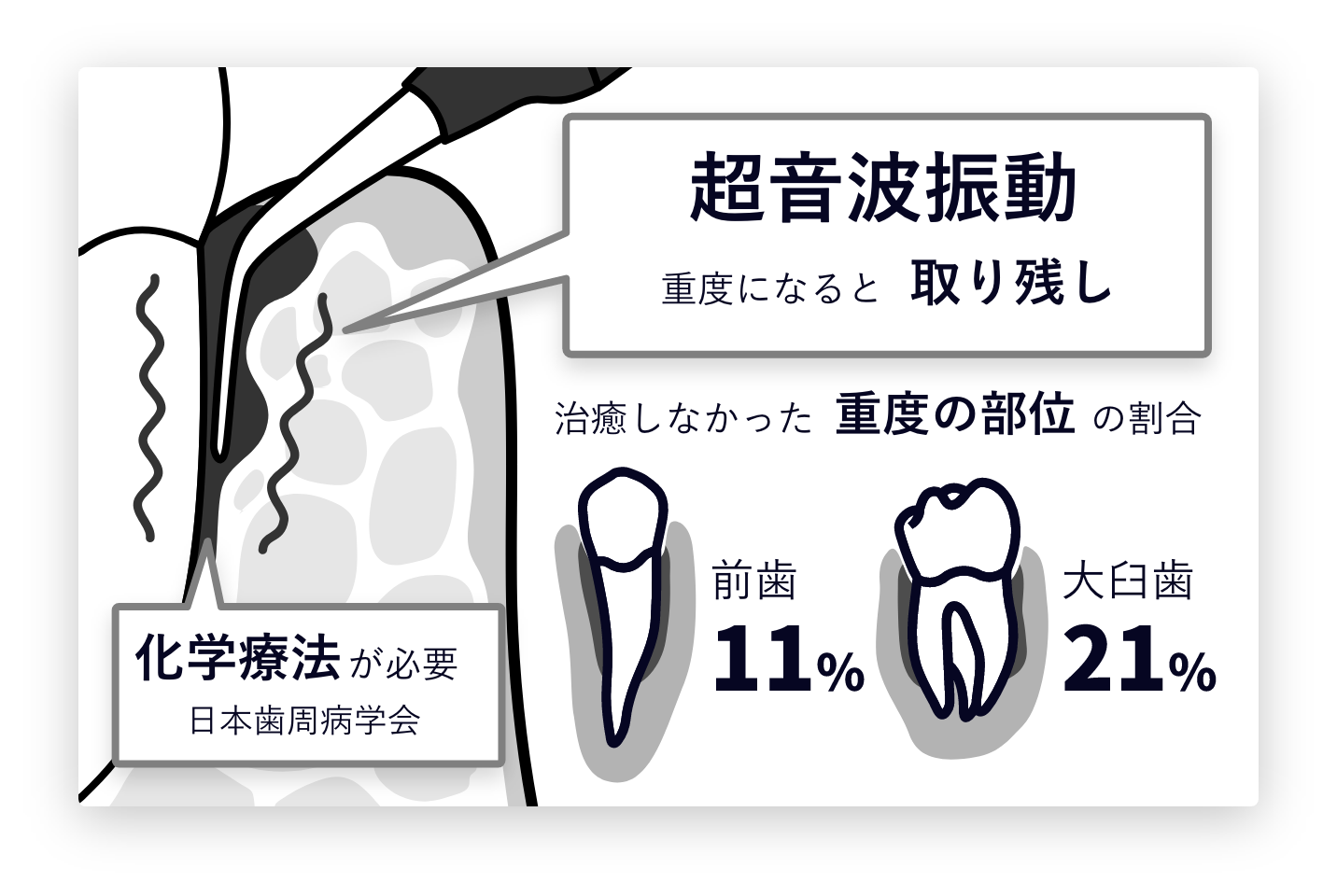 超音波振動のみ